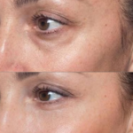 juvelook-skin-booster